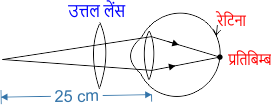 hypermetropia in hindi